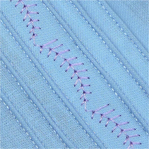 Husqvarna Viking Pintuck Foot with Decorative Stitch Guide - Image 11